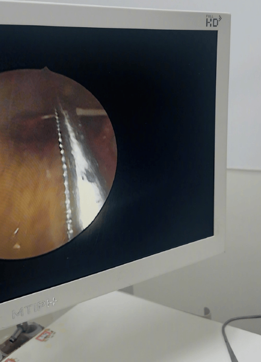 柳岩因喉咙卡鱼刺去医院后发文：一定要及时就医