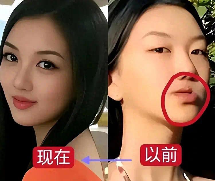 去掉兔唇后的李嫣惊为天人，果然，有王菲李亚鹏当爸妈就是不一样封面图